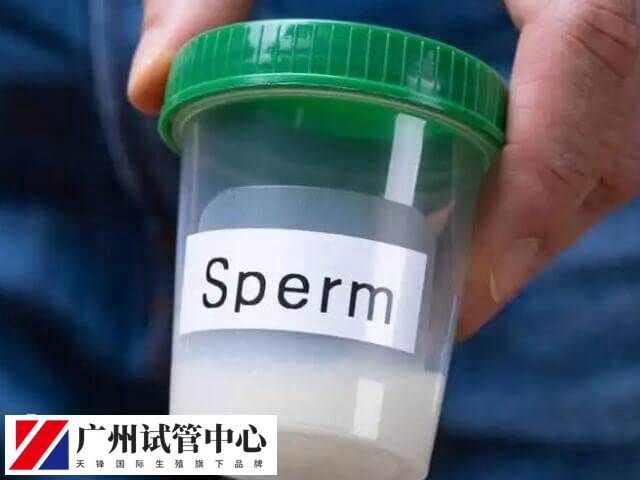 生殖中心需要须做精液检查